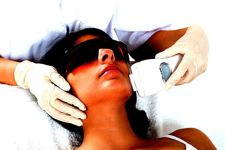 Safe laser hair removal while pregnant hair regrowth